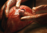 Kā šobrīd izskatās mazulis no slavenā foto «Cerības roka» FOTO,VIDEO
