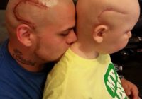 Lai atbalstītu dēlu, tēvs ietetovē tādu rētu kā dēlam, kas cieš no vēža! FOTO