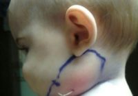 Šis mazulis bieži kasīja kaklu. Iemesls pārsteidza pat pieredzējušus ārstus… FOTO
