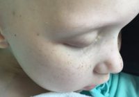 Septiņgadīgajai meitenītei pēc ķīmijterapijas palikusi pēdējā skropstiņa… FOTO