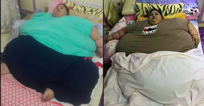 Resnākā sieviete pasaulē zaudējusi pusi sava svara 2 mēnešu laikā